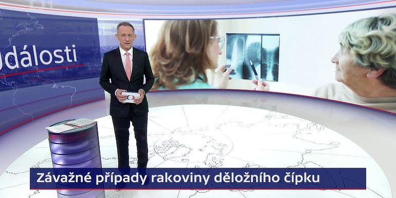 Anotační obrázek