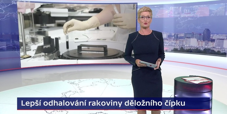 Anotační obrázek