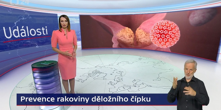 Anotační obrázek